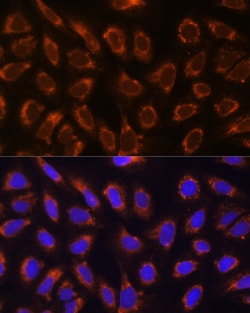 Invitrogen GANAB Polyclonal Antibody 100 &mu;L; Unconjugated:Antibodies,