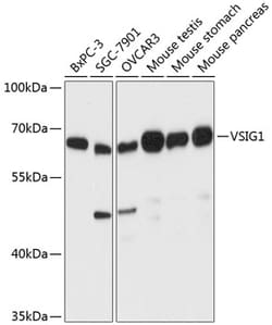 Invitrogen VSIG1 Polyclonal Antibody 100 &mu;L; Unconjugated:Antibodies,