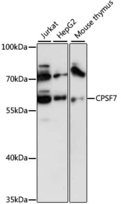 Invitrogen CPSF7 Polyclonal Antibody 100 &mu;L; Unconjugated:Antibodies,