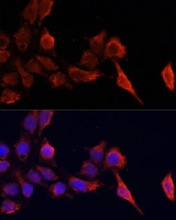 Invitrogen TIMP1 Polyclonal Antibody 100 &mu;L; Unconjugated:Antibodies,