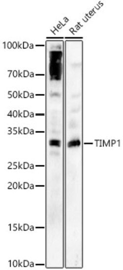 Invitrogen TIMP1 Polyclonal Antibody 100 &mu;L; Unconjugated:Antibodies,