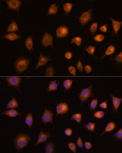 Invitrogen PKM2 Polyclonal Antibody 100 &mu;L; Unconjugated:Antibodies,