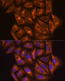 Invitrogen PKM2 Polyclonal Antibody 100 &mu;L; Unconjugated:Antibodies,