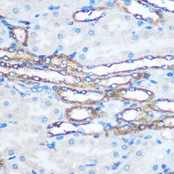 Invitrogen PKM2 Polyclonal Antibody 100 &mu;L; Unconjugated:Antibodies,