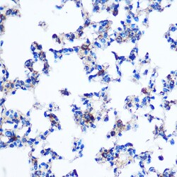 Invitrogen PKM2 Polyclonal Antibody 100 &mu;L; Unconjugated:Antibodies,
