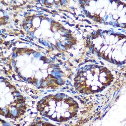Invitrogen PKM2 Polyclonal Antibody 100 &mu;L; Unconjugated:Antibodies,