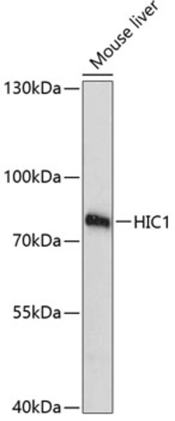 Invitrogen HIC1 Polyclonal Antibody 100 &mu;L; Unconjugated:Antibodies,