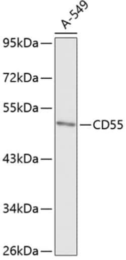 Invitrogen CD55 Polyclonal Antibody 100 &mu;L; Unconjugated:Antibodies,