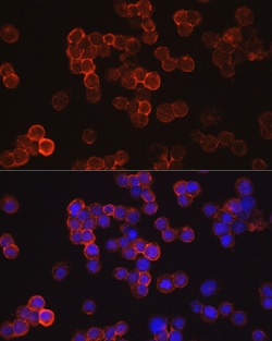 Invitrogen CD34 Polyclonal Antibody 100 &mu;L; Unconjugated:Antibodies,