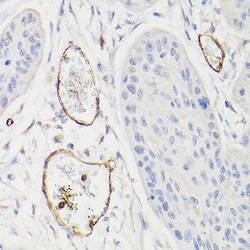 Invitrogen CD34 Polyclonal Antibody 100 &mu;L; Unconjugated:Antibodies,
