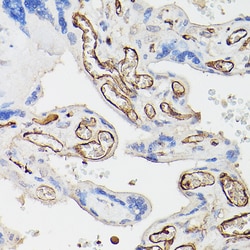 Invitrogen CD34 Polyclonal Antibody 100 &mu;L; Unconjugated:Antibodies,