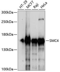 Invitrogen SMC4 Polyclonal Antibody 100 &mu;L; Unconjugated:Antibodies,