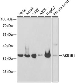 Invitrogen AKR1B1 Polyclonal Antibody 100 &mu;L; Unconjugated:Antibodies,