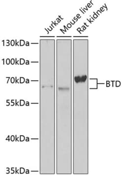 Invitrogen BTD Polyclonal Antibody 100 &mu;L | Buy Online | Invitrogen&trade; | Fisher Scientific