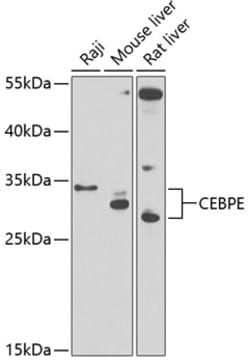 Invitrogen C/EBP epsilon Polyclonal Antibody 100 &mu;L; Unconjugated:Antibodies,