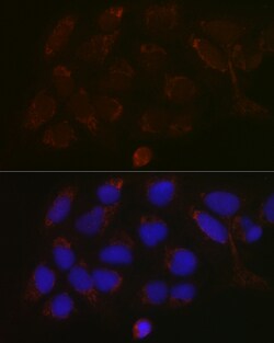 Invitrogen GALNT3 Polyclonal Antibody 100 &mu;L; Unconjugated:Antibodies,