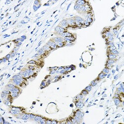 Invitrogen GALNT3 Polyclonal Antibody 100 &mu;L; Unconjugated:Antibodies,