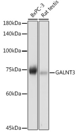 Invitrogen GALNT3 Polyclonal Antibody 100 &mu;L; Unconjugated:Antibodies,