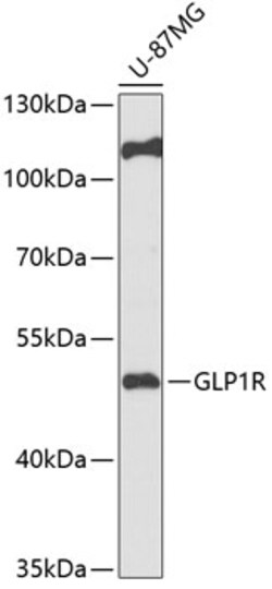 Invitrogen GLP1R Polyclonal Antibody 100 &mu;L | Buy Online | Invitrogen&trade; | Fisher Scientific