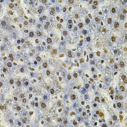 Invitrogen IFI16 Polyclonal Antibody 100 &mu;L; Unconjugated:Antibodies,