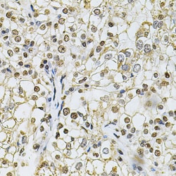 Invitrogen IFI16 Polyclonal Antibody 100 &mu;L; Unconjugated:Antibodies,