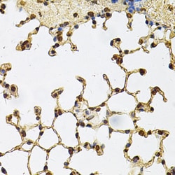Invitrogen IFI16 Polyclonal Antibody 100 &mu;L; Unconjugated:Antibodies,