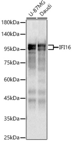 Invitrogen IFI16 Polyclonal Antibody 100 &mu;L; Unconjugated:Antibodies,