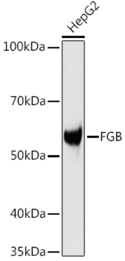 Invitrogen FIBB Polyclonal Antibody 100 &mu;L; Unconjugated:Antibodies,