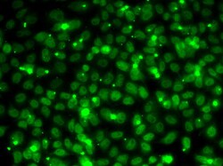 Invitrogen RPA14 Polyclonal Antibody 100 &mu;L; Unconjugated:Antibodies,