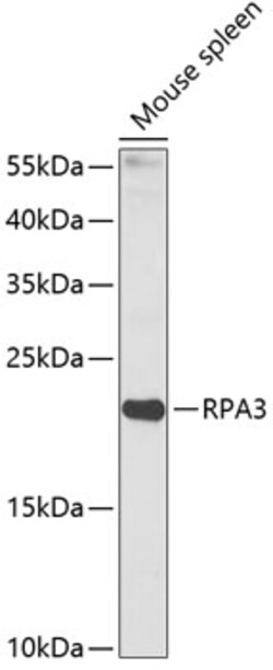 Invitrogen RPA14 Polyclonal Antibody 100 &mu;L; Unconjugated:Antibodies,