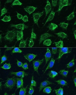 Invitrogen PTPN22 Polyclonal Antibody 100 &mu;L; Unconjugated:Antibodies,