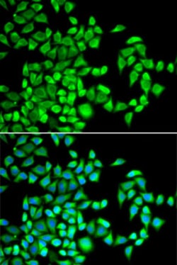 Invitrogen ABH1 Polyclonal Antibody 100 &mu;L; Unconjugated:Antibodies,