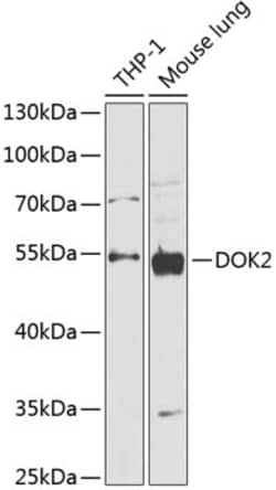 Invitrogen DOK2 Polyclonal Antibody 100 &mu;L; Unconjugated:Antibodies,