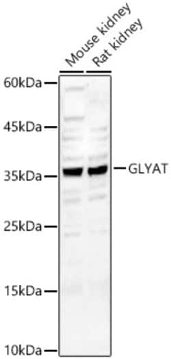 Invitrogen GLYAT Polyclonal Antibody 100 &mu;L; Unconjugated:Antibodies,