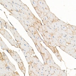 Invitrogen Dystrophin Polyclonal Antibody 100 &mu;L; Unconjugated:Antibodies,