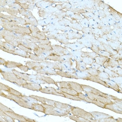 Invitrogen Dystrophin Polyclonal Antibody 100 &mu;L; Unconjugated:Antibodies,