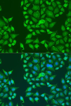 Invitrogen STAU2 Polyclonal Antibody 100 &mu;L; Unconjugated:Antibodies,