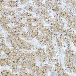 Invitrogen HRI Polyclonal Antibody 100 &mu;L; Unconjugated:Antibodies,