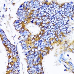 MRPL13 Polyclonal Antibody, Invitrogen 100 &mu;L; Unconjugated:Antibodies,