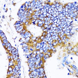 MRPL13 Polyclonal Antibody, Invitrogen 100 &mu;L; Unconjugated:Antibodies,