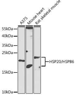 Invitrogen HSP20 Polyclonal Antibody 100 &mu;L; Unconjugated:Antibodies,