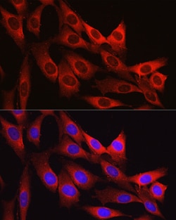 Invitrogen™ Vinculin Polyclonal Antibody