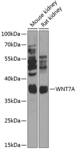 Invitrogen WNT7A Polyclonal Antibody 100 &mu;L | Buy Online | Invitrogen&trade; | Fisher Scientific