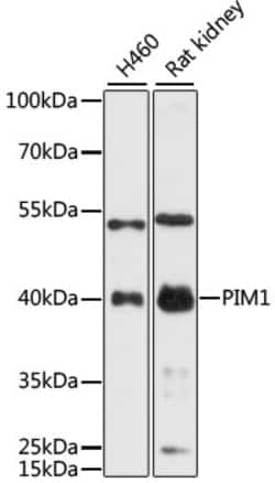 Invitrogen PIM1 Polyclonal Antibody 100 &mu;L; Unconjugated:Antibodies,