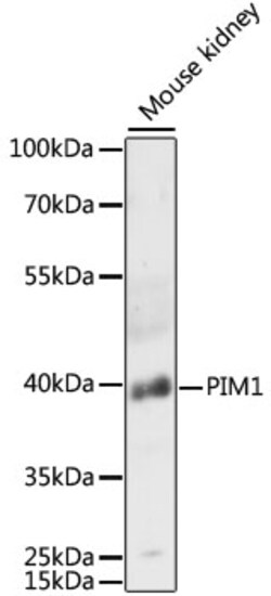 Invitrogen PIM1 Polyclonal Antibody 100 &mu;L; Unconjugated:Antibodies,