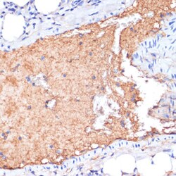 Invitrogen ApoA1 Polyclonal Antibody 100 &mu;L; Unconjugated:Antibodies,