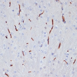 Invitrogen ApoA1 Polyclonal Antibody 100 &mu;L; Unconjugated:Antibodies,