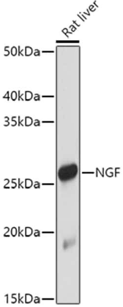 Invitrogen NGF Polyclonal Antibody 100 &mu;L; Unconjugated:Antibodies,