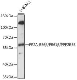 Invitrogen PPP2R5B Polyclonal Antibody 100 &mu;L | Buy Online | Invitrogen&trade; | Fisher Scientific