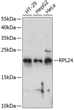Invitrogen RPL24 Polyclonal Antibody 100 &mu;L | Buy Online | Invitrogen&trade; | Fisher Scientific